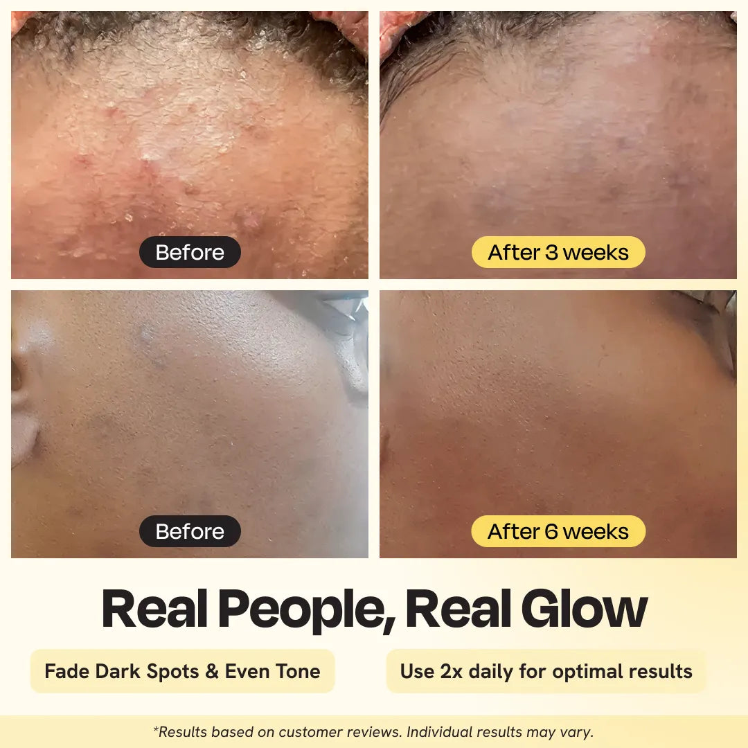 Skin close-ups showing hydrated appearance after applying white facial cream