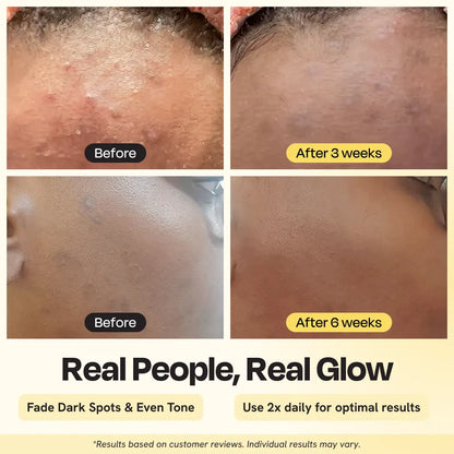 Skin close-ups showing hydrated appearance after applying white facial cream