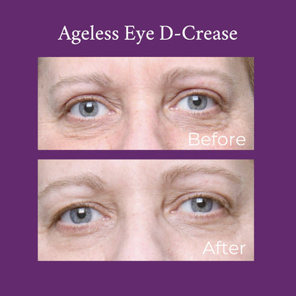 Close-up of eyes showing before and after for eye cream