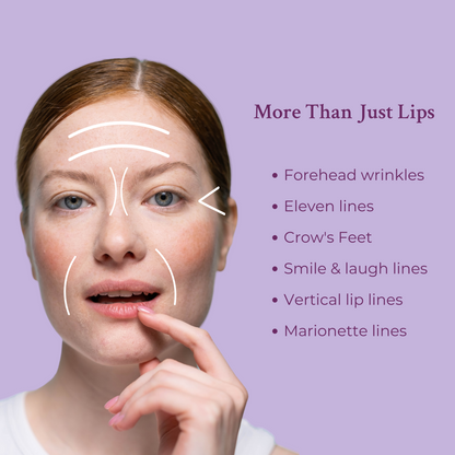 Lip filler application on a woman’s lower lip with fingertip, close-up