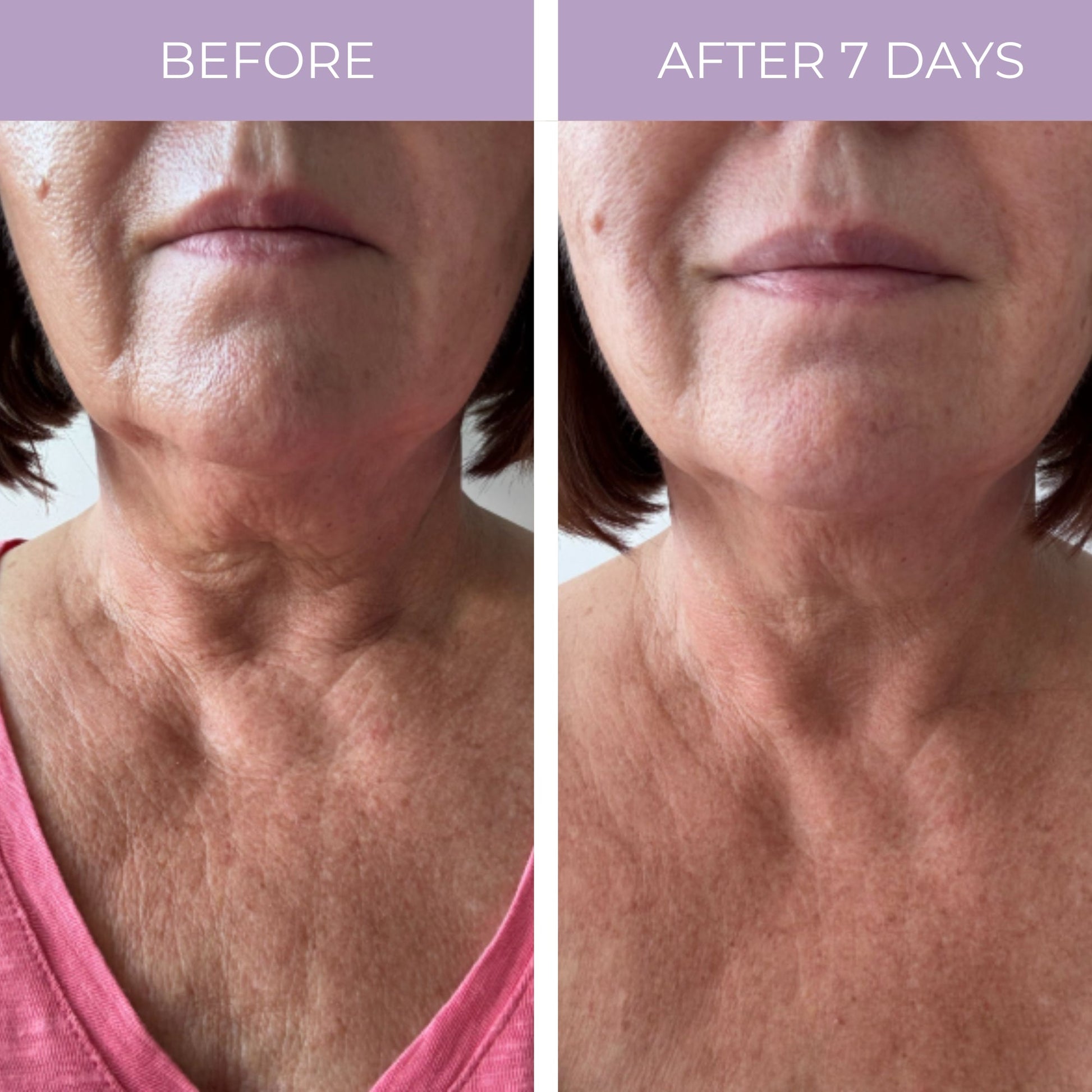 Split view of woman’s neck skin: before and after 7 days