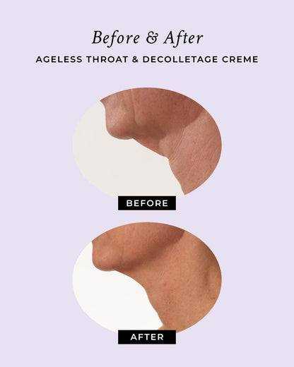 Neck area close-ups with round panels labeled BEFORE and AFTER