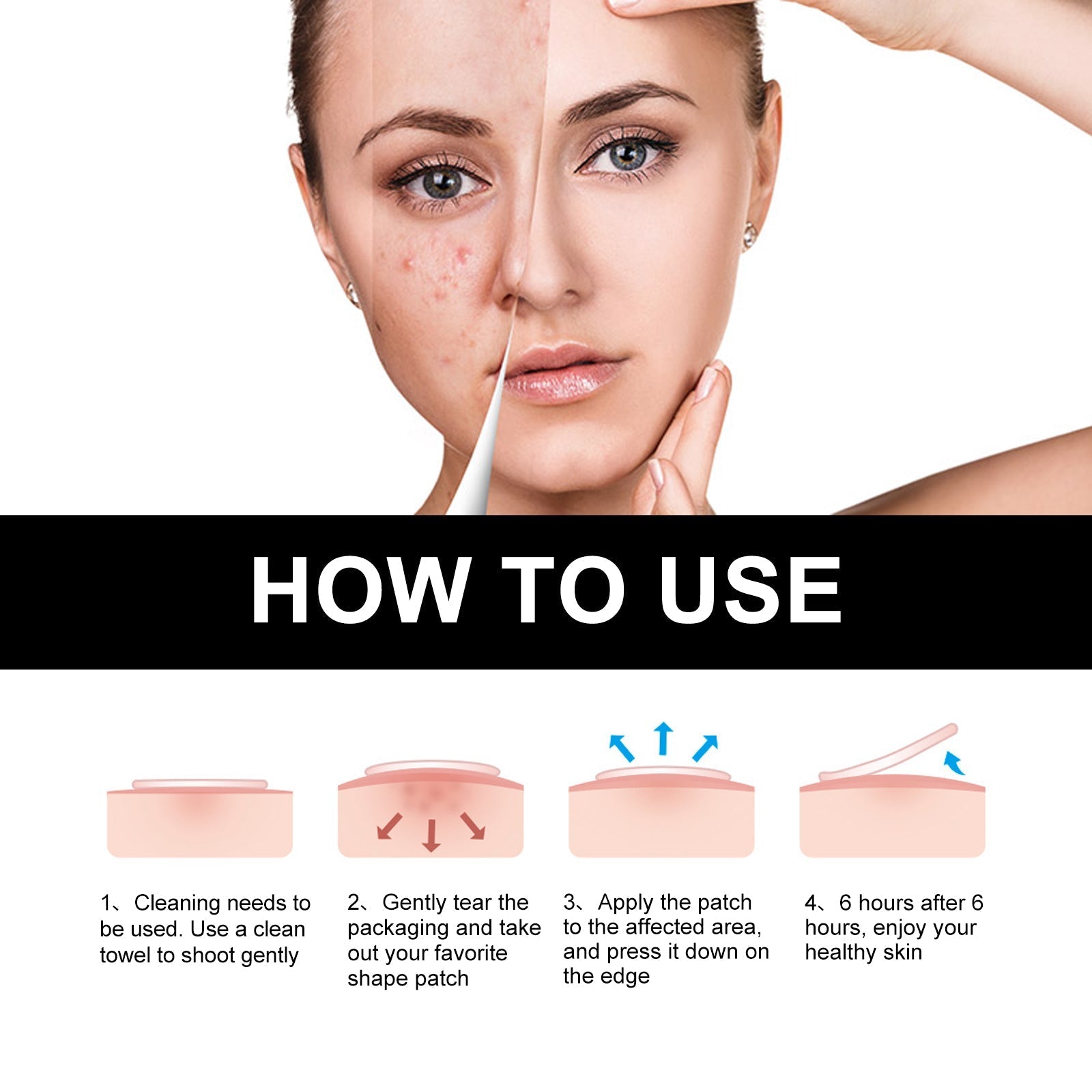 Acne patch how-to-use steps with patch placement icons