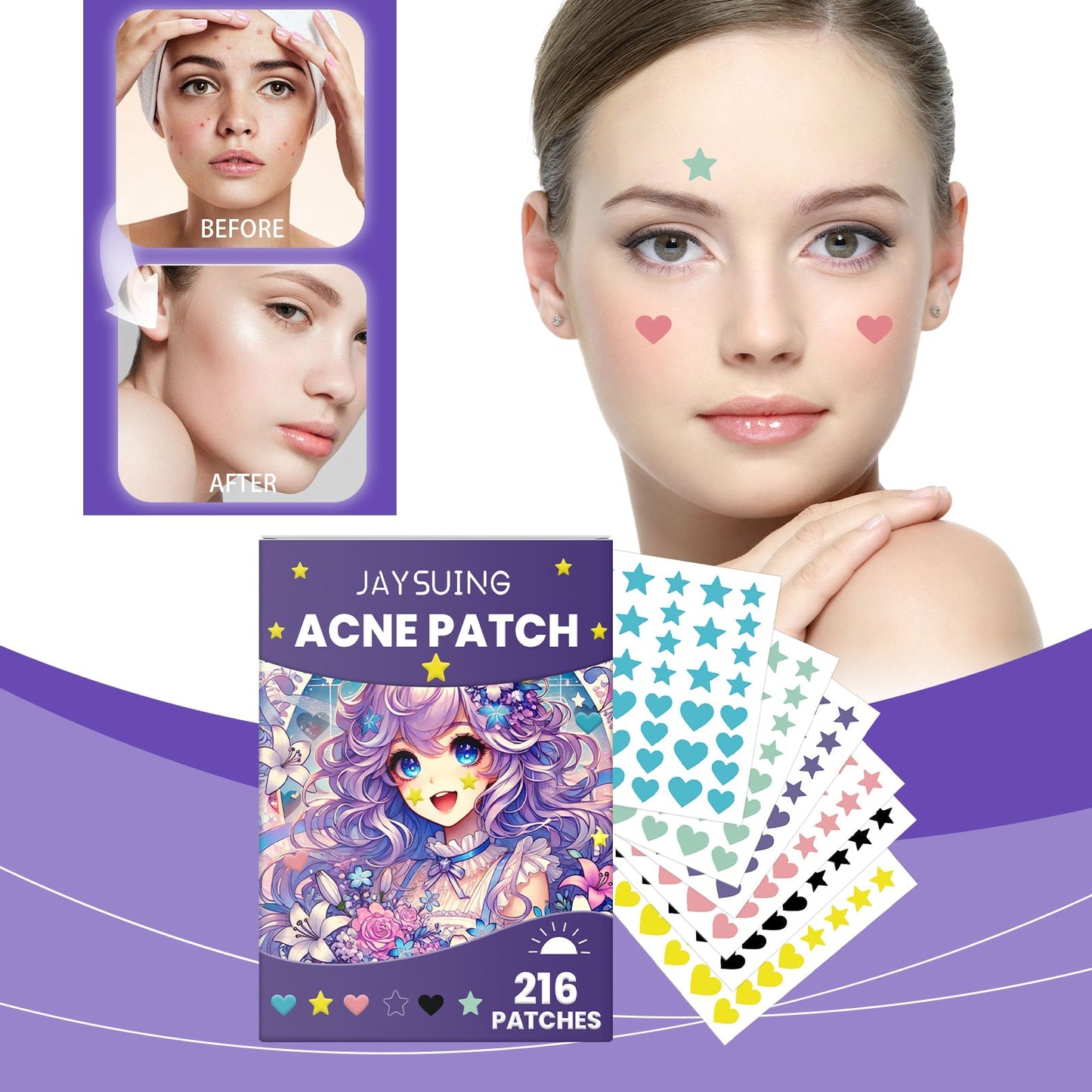 Acne patches on face with colorful patch sheets and product box beside