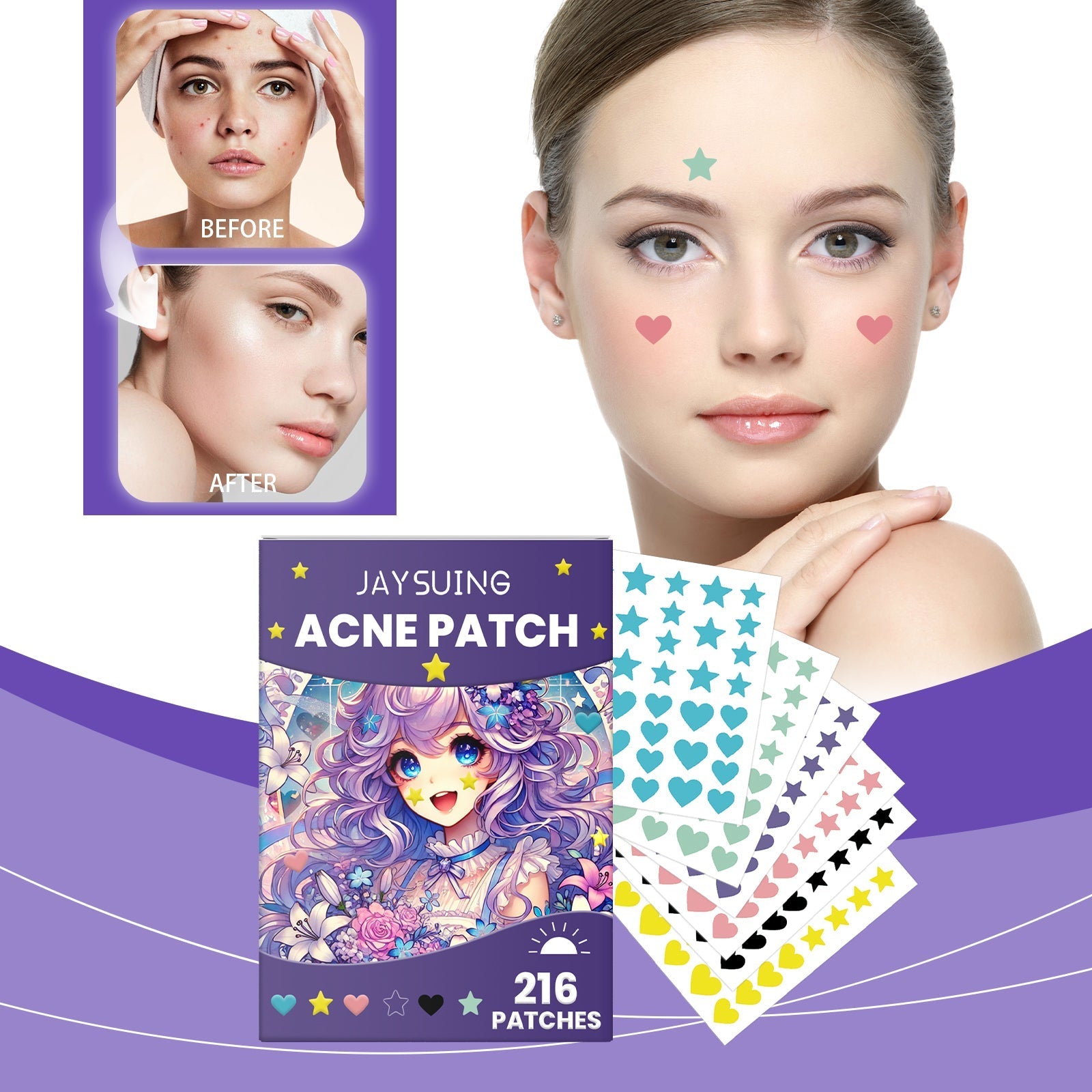 Acne patches on face with colorful patch sheets and product box beside