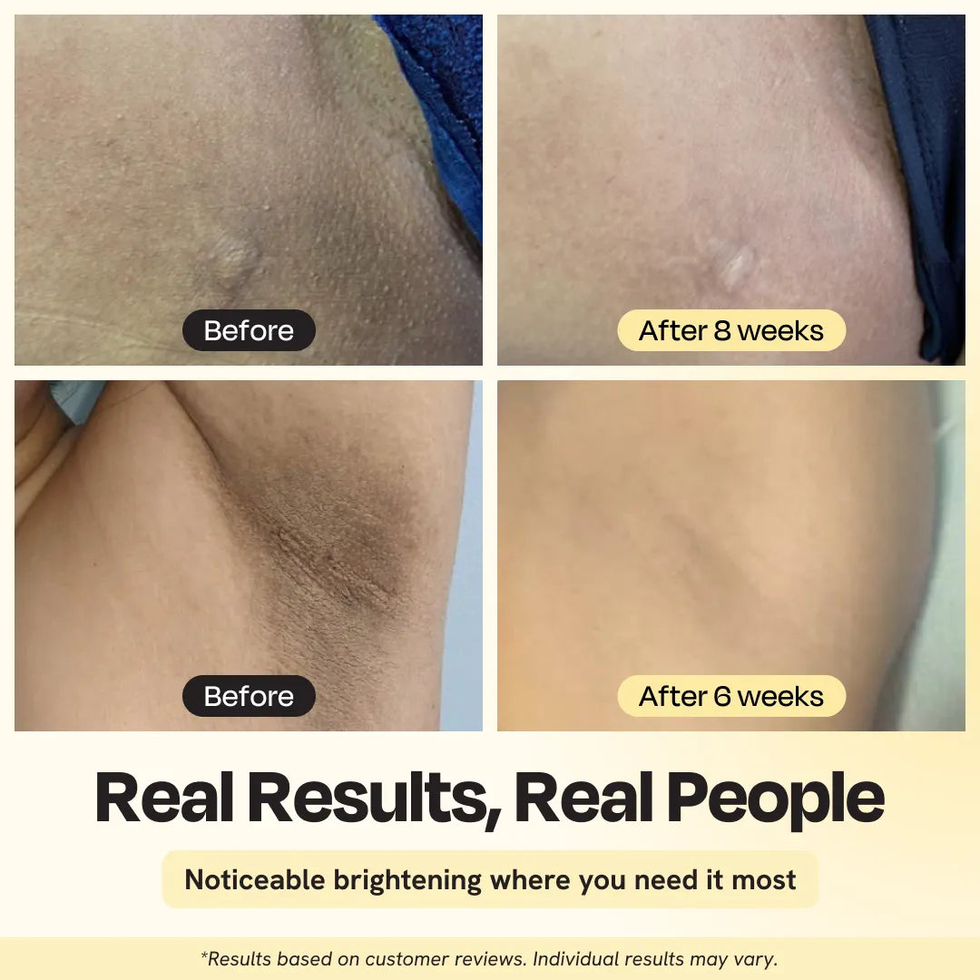 Before-and-after skin close-ups in four panels, showing reduced dark marks.