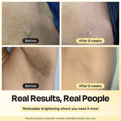 Before-and-after skin close-ups in four panels, showing reduced dark marks.