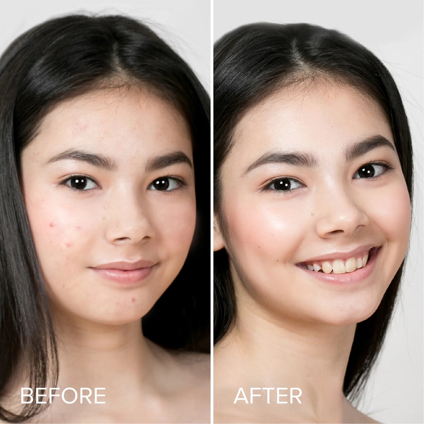 Before and after portraits showing clearer skin on a woman’s face