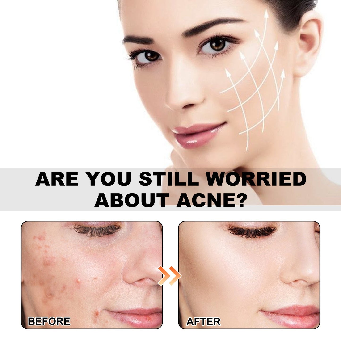 Facial skincare with acne treated area, hydrocolloid patch look for clearer skin