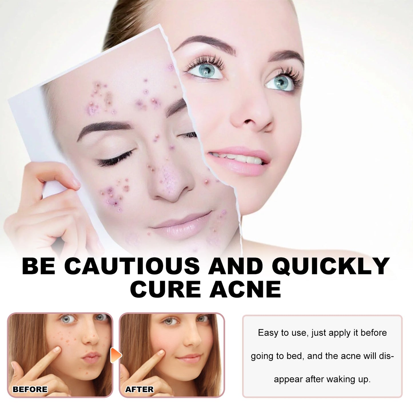 Hydrocolloid acne patch use on face, woman pressing patches over blemishes