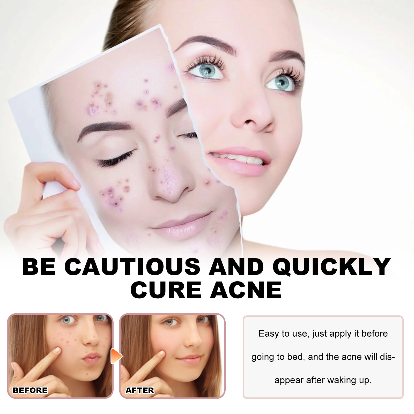 Hydrocolloid acne patch use on face, woman pressing patches over blemishes