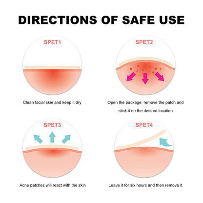 Hydrocolloid acne patch directions diagram: cleanse, place patch, leave hours, remove