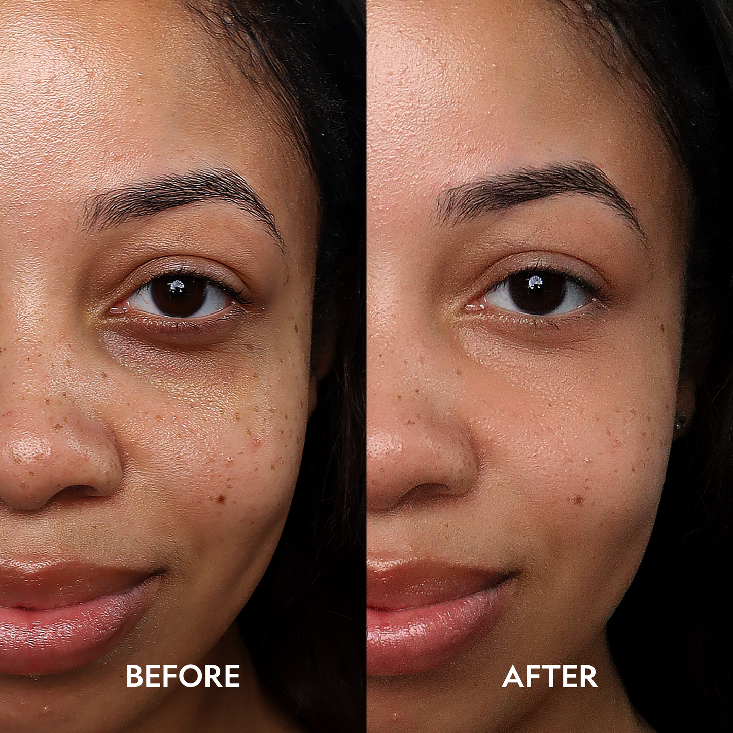 Under-eye area before-and-after comparison, with corrected under-eye tones