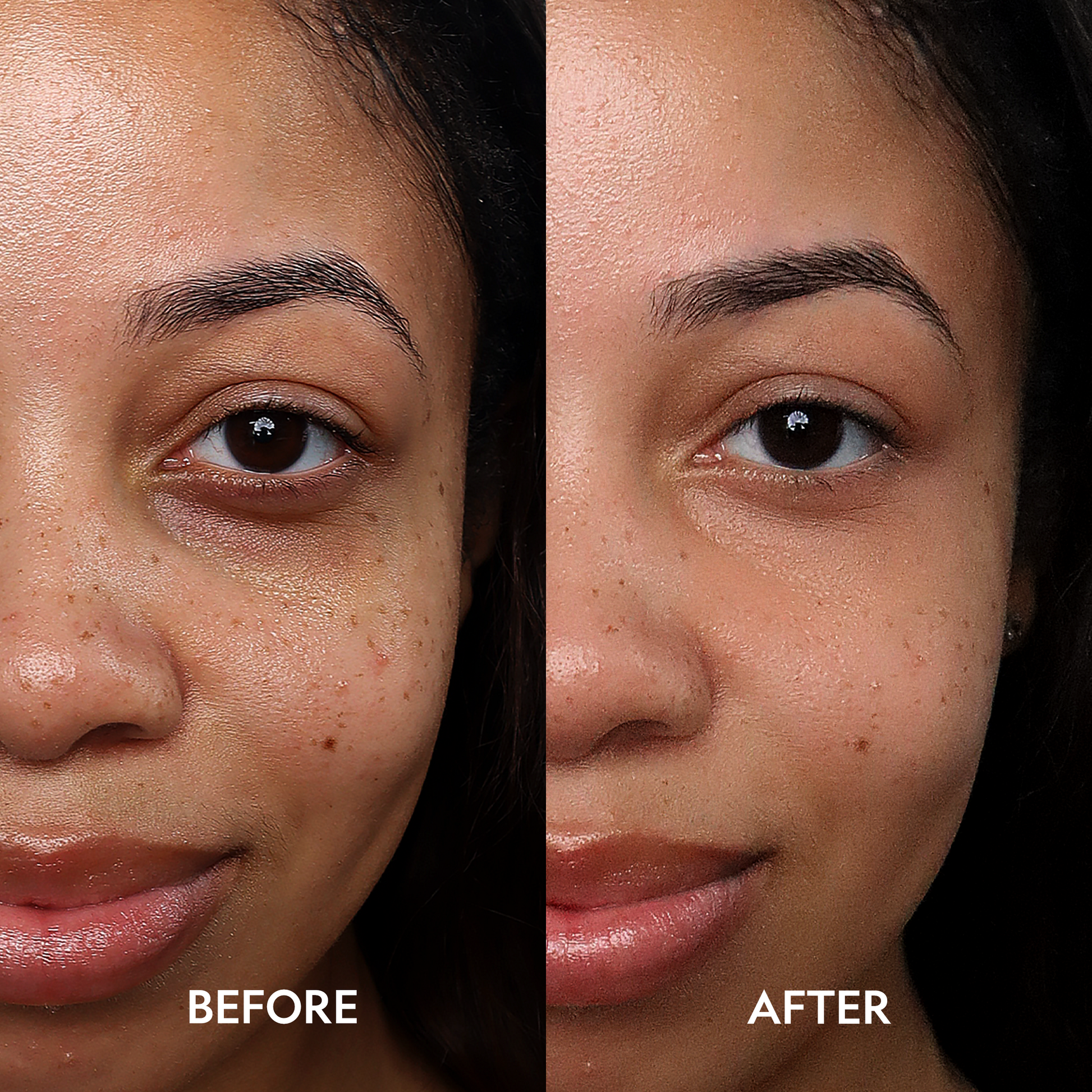 Under-eye area before-and-after comparison, with corrected under-eye tones