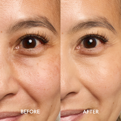 Under-eye area with visible dark circles, before-and-after comparison on skin