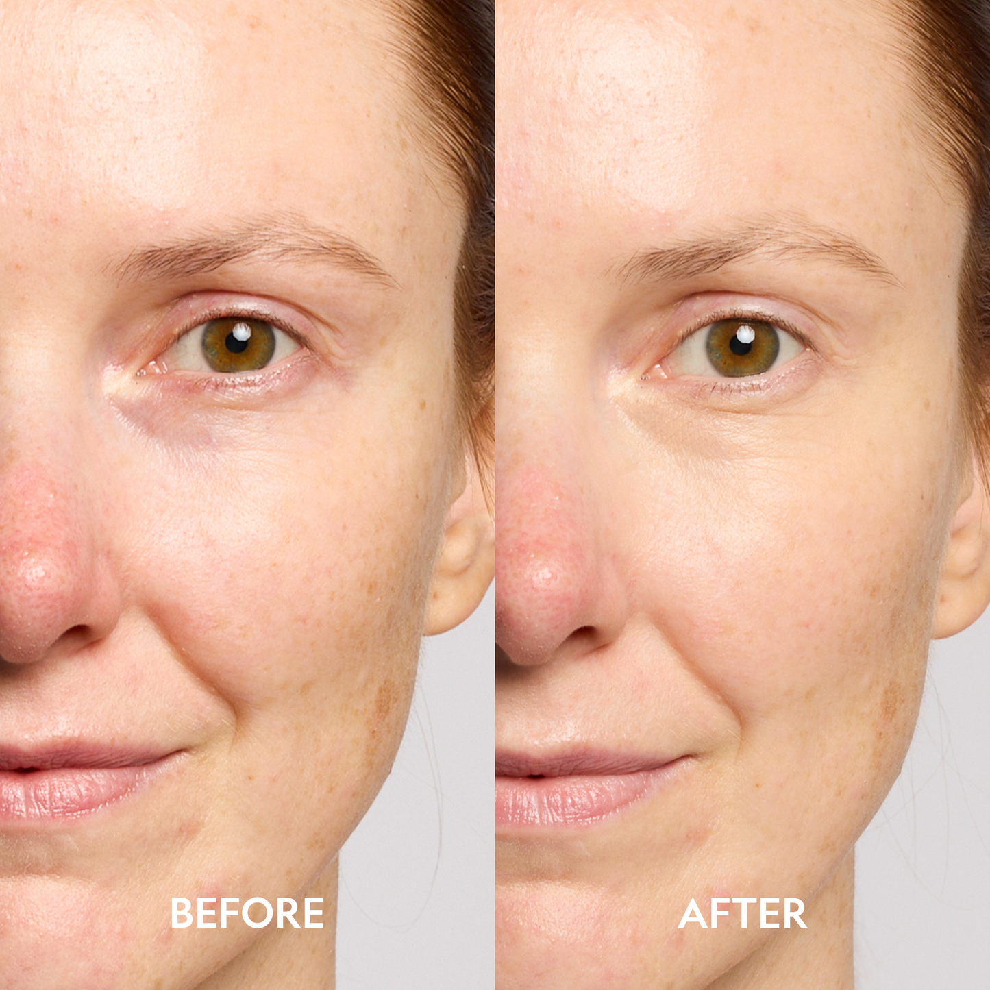Model eye area showing before and after look for dark-circle brightening