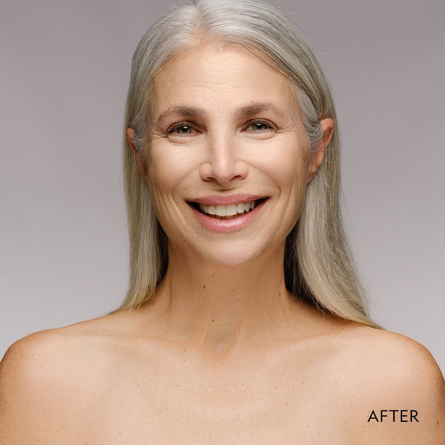 Woman face with matte powder foundation finish, marked AFTER in corner