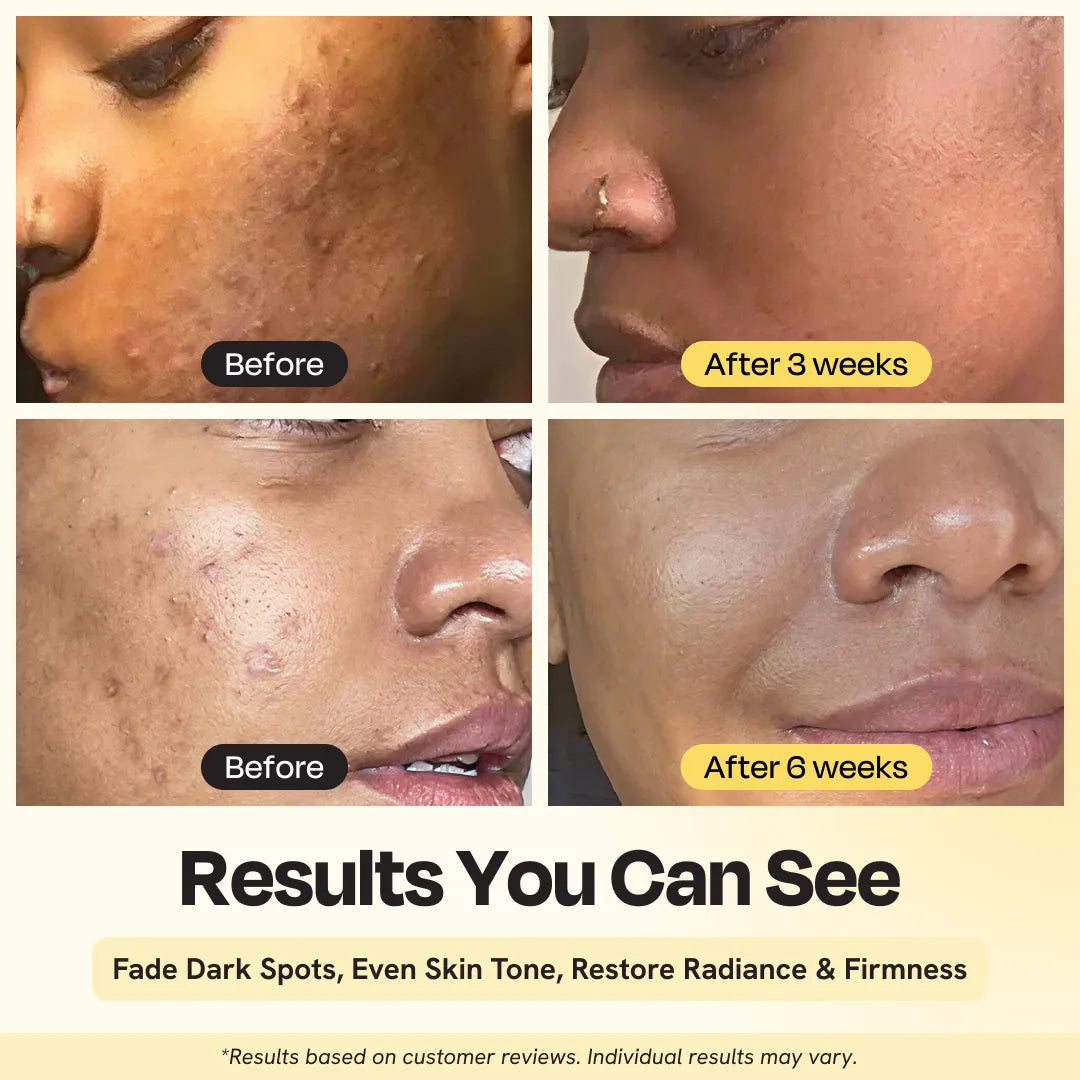 Four close-up face views showing skin before and after using vitamin C serum