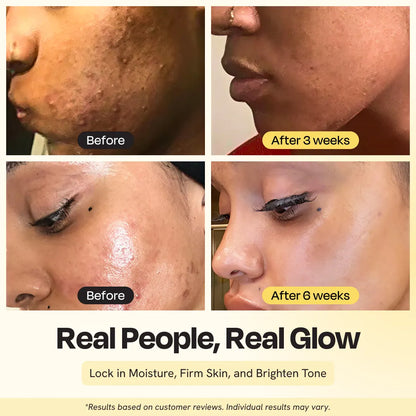 Face close-up skin comparison with facial oil before and after