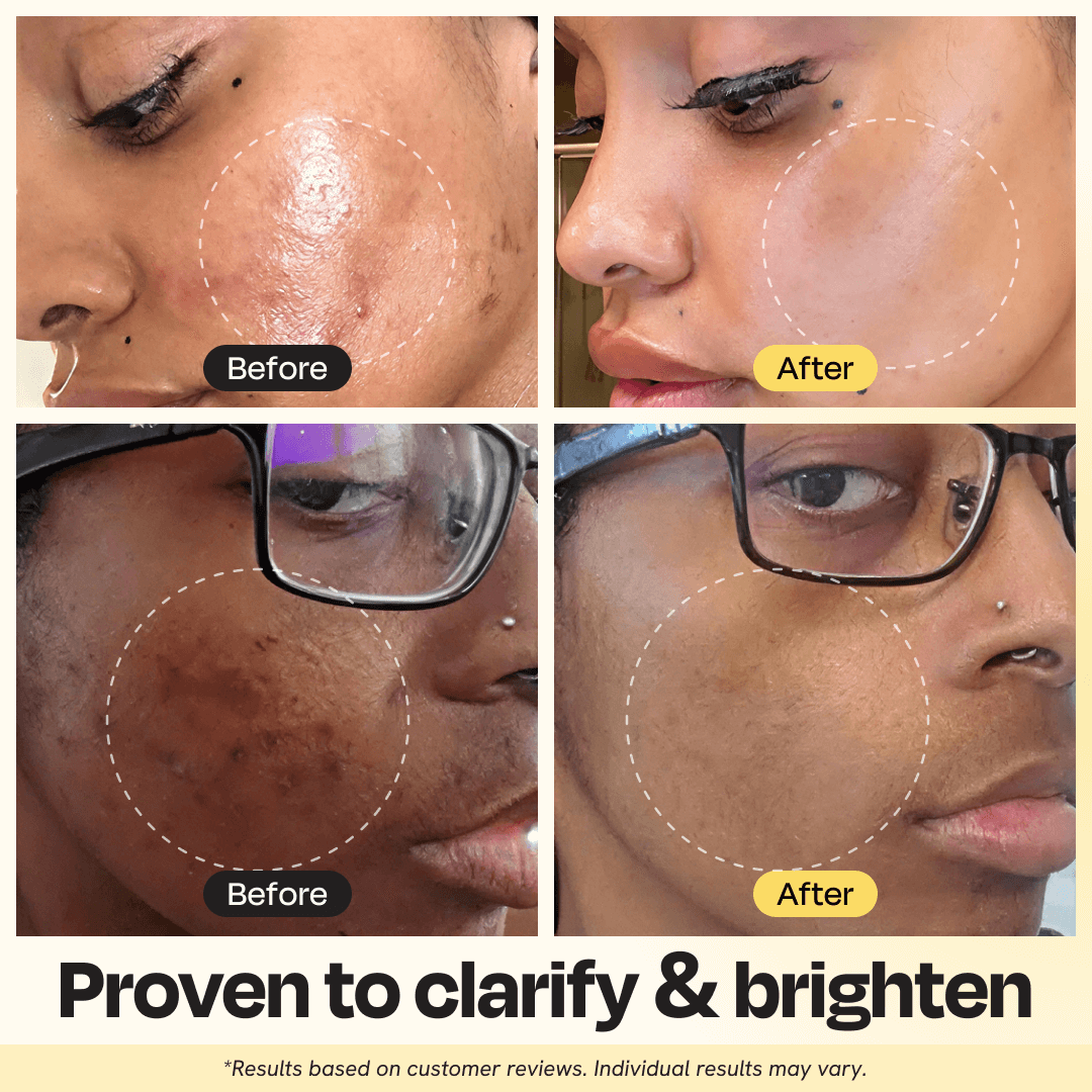 Vitamin C clay mask applied to face with marked area, after results shown